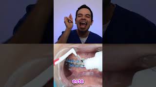 ¡ASÍ DEBES USAR EL CEPILLO INTERDENTAL DE ORTODONCIA BRACKETS SIN CARIES😎 shorts [upl. by Odlanyar]