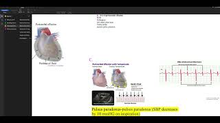 Oncological Emergencies Screen Recording 2023 10 27 at 3 15 20 PM [upl. by Linsk]