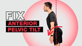 Fix Anterior Pelvic Tilt – Fast [upl. by Enihpets182]