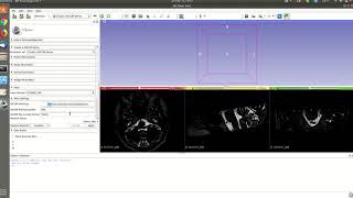 3D Slicer NRRD to DICOM or DICOM to NRRD [upl. by Oakley]