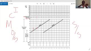 partograph OSCE [upl. by Marquez488]