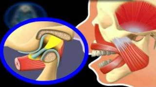 Clicking of the Jaw [upl. by Elledoj886]