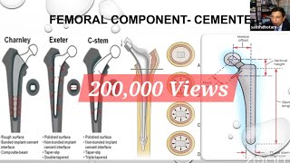 Biomechanics of Total Hip Replacement for the FRCSOrth [upl. by Wagshul411]