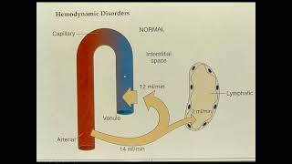 Patología General  Trastornos Hemodinámicos 11 [upl. by Gilead]