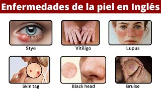 Enfermedades de la Piel en Inglés [upl. by Sperling]