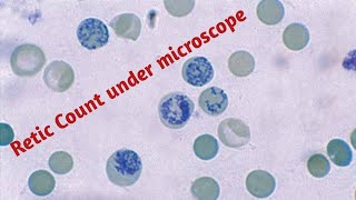 Reticulocyte  Reticulocyte count test in hindi [upl. by Whitelaw218]