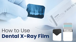 How to use Dental XRay Film  Waldent Dental XRay Film IOPA [upl. by Shanta147]