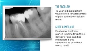 Advances in Endodontic Treatment Part 1Diagnosis and Treatment Planning [upl. by Aiuqram]