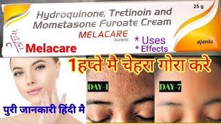 Melacare Cream गोरा होने की क्रीम Pimples Remove Cream Melacare Cream Review in Hindi Use effect [upl. by Relyat]