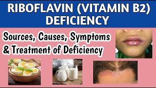 Riboflavin Vitamin B2 Deficiency Causes Symptoms amp Treatment [upl. by Searby490]