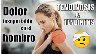 TENDINITIS y TENDINOSIS de HOMBRO 🦾 TRATAMIENTO de TENDINOPATÍAS 💯 Dr EDSON SERRANO  NEOMEDICA [upl. by Leahcimed576]