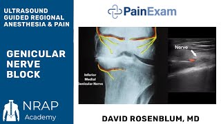 Ultrasound Guided Genicular Nerve Block PainExam Ultrasound Training Watch and Earn 1 CME Credit [upl. by Yunfei]