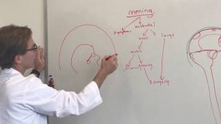 Brain Tumors 101 Meningioma Brain Tumors [upl. by Allina]