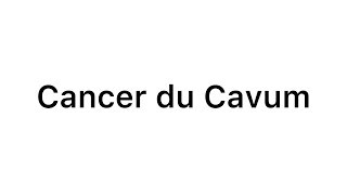 📍 Cancer du Cavum  ORL  khadidja ferdj 🔥 [upl. by Anivram739]