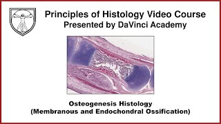 Osteogenesis Histology Membranous and Endochondral Ossification Bone Histology Part 3 of 3 [upl. by Obara78]