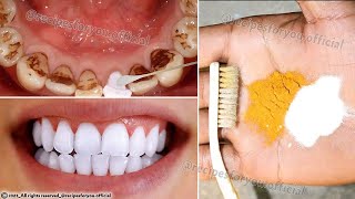 Secret that Dentists dont want you to know Remove Tartar and Teeth Whitening in just 2 minutes [upl. by Horwath]