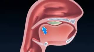 El proceso deglutorio [upl. by Eetnahc]