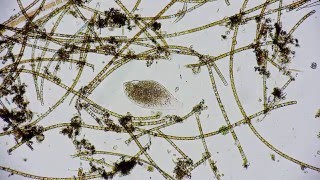 🔬 living under a microscope 3  smooth microcosmos life in a drop of water amp ralaxing sound Full HD [upl. by Akinhoj]