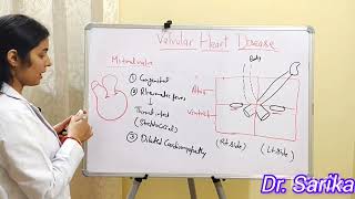 10 VALVULAR HEART DISEASE [upl. by Aksoyn76]