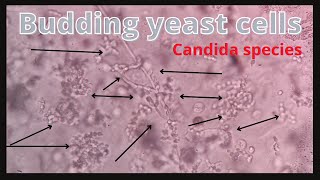 Budding yeast cells in urine  Candida Species  Pseudohyphae medicallabtechnologysajal6903 [upl. by Nyrmak990]