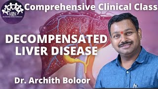 DECOMPENSATED LIVER DISEASE clinical case presentation [upl. by Eittod921]