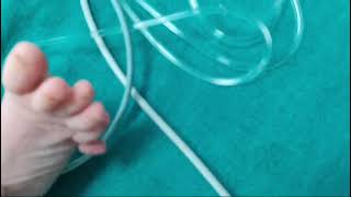 polydactyly baby newlyborn babydevelopment cute [upl. by Alisander]