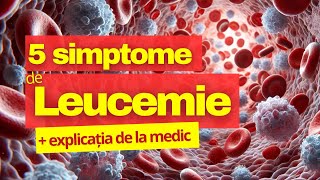 5 simptome explicate LEUCEMIE [upl. by Arliene220]