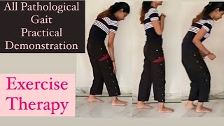 All Pathological Gait demonstration Exercise Therapy [upl. by Stauder]