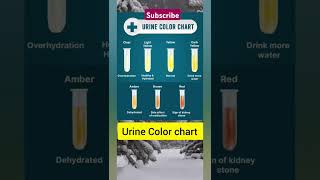 Urine colour charturinecolormedicalstudentmedical [upl. by Spearman]