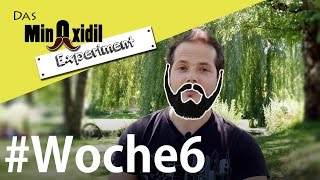 Bleibt der Bart auch nach dem Absetzen  Das Minoxidil Experiment Woche6 [upl. by Buckels]