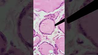 INCREÍBLE ¿Cómo reconocer al folículo tiroideo y sus células en microscopio tiroides histología [upl. by Coyle151]