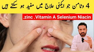 Top 4 Vitamins for Quick Acne Treatment Acne Vulgaris [upl. by Stratton630]