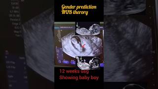 12weeks Ultrasound of baby boygender prediction nub theory shortsfeed reels [upl. by Anitnuahs]