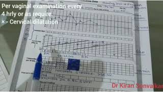 Partograph  How to Use it [upl. by Hoj]
