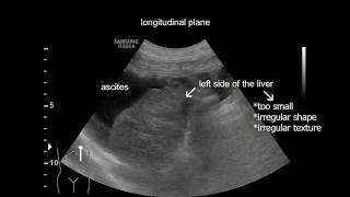 Liver cirrhosis in a dog [upl. by Asseret]