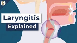 Why Do You Lose Your Voice  Laryngitis Explained [upl. by Eiramlehcar593]