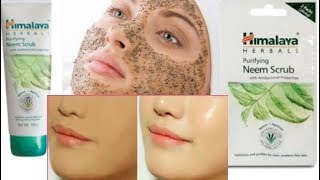 Himalaya Neem Scrub For Oily SkinBlacheads Acne amp Glowing Skin ReviewPrice amp How to Use [upl. by Yentyrb555]