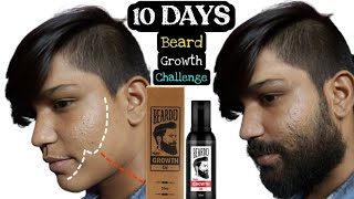 Beardo Beard Growth 90 Days Challenge  Best Beard Oil For Patchy Beard in India 2024 [upl. by Yerkovich]