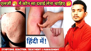 Allergy in hindi  एलर्जी में use होने वाले दवाई 😱  symptoms types  antiallergic medicine [upl. by Ellenwad231]