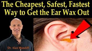 Cheapest Safest Fastest Way to Get the Ear Wax Out  Dr Alan Mandell DC [upl. by Zetnwahs]