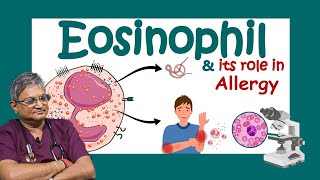 ইওসিনোফিল কি Why Eosinophils are SO Important for Your Body Role of eosinophils in allergy [upl. by Nevs]