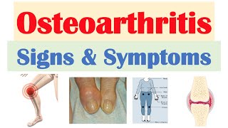 Osteoarthritis Signs amp Symptoms amp Why They Occur [upl. by Deuno]