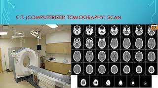 CT  computerized tomography Scan  in hindi [upl. by Yduj]