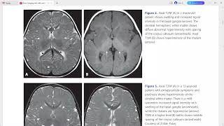 ultrasound radiologysonology [upl. by Kier]