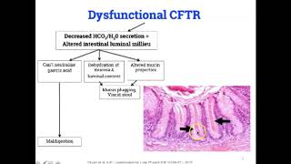 Cystic Fibrosis Gastrointestinal Manifestations Part 1 [upl. by Sharman642]