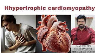 Hypertrophic Cardiomyopathy Everything You Need to Know In Tamil [upl. by Retepnhoj163]