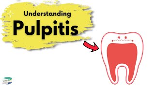 What is Pulpitis  Endodontics [upl. by Fahland906]