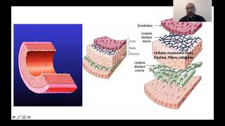 01 Rhumatisme ariculaire aigu Dr M Chettibi  Cardio [upl. by Hernando]