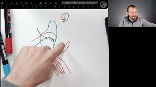 4a Steps for aesthetic crown lengthening Day 3 [upl. by Vincent]