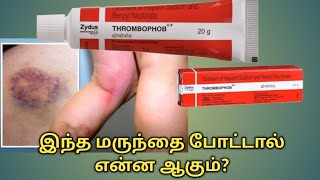 Thrombophob ointment uses in tamilThrombophob ointment benefits in tamilThrombophob ointment uses [upl. by Nichole502]